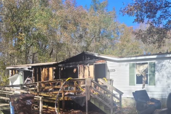 102-Year-Old Man Hospitalized With Burns From Early Morning Maryland Fire