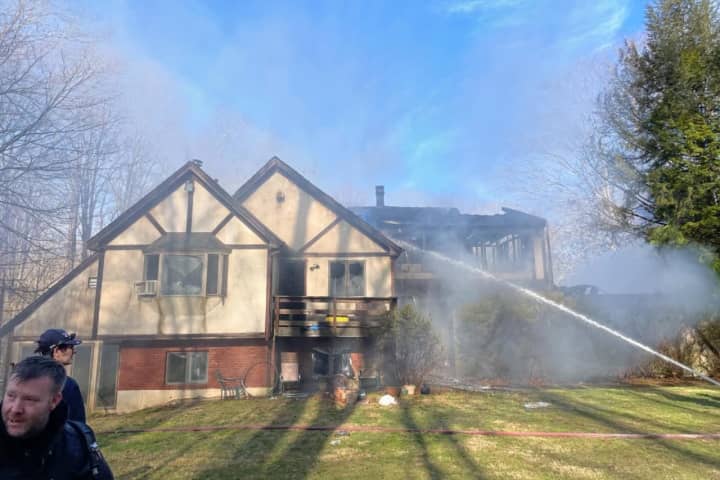 Update: Funds Come To Pound Ridge Firefighter Hurt In Bedford Blaze