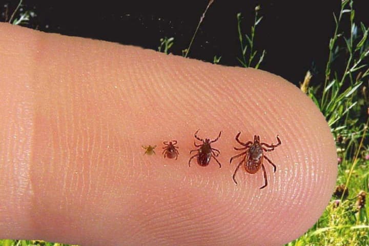 Deadly Tick-Borne Virus Confirmed In Dutchess For Second Straight Year