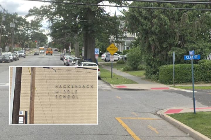 Hackensack Middle School Student Hospitalized After Colliding With SUV