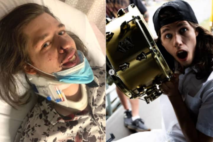 Band From Region Cancels Future Shows After Drummer's Brutal Attack