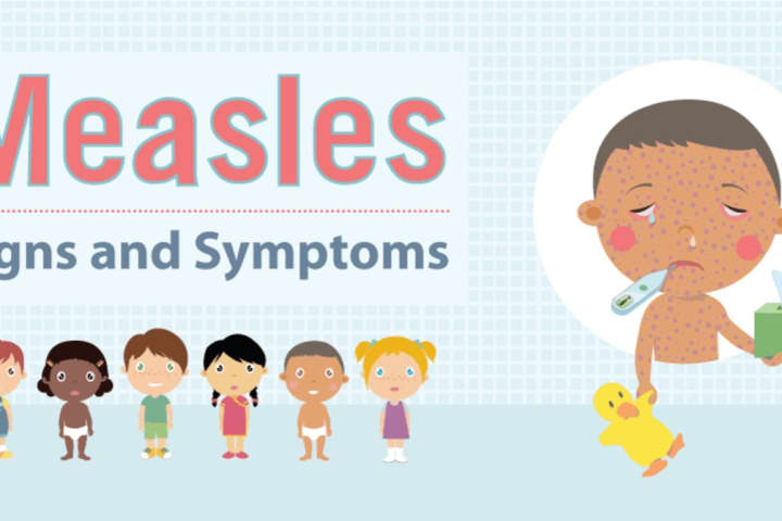 Orange County Reports Two Possible Measles Exposure Locations