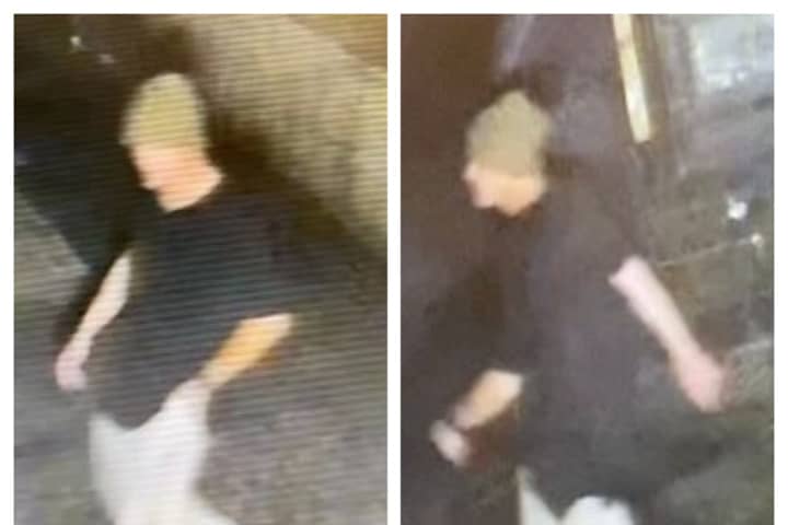 Do You Know The Man In The Cast? Central Mass Police Say He's Behind Break-in