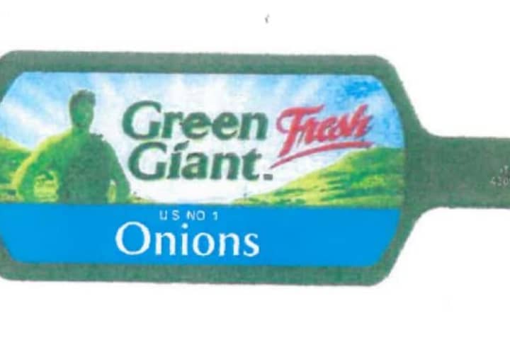 Two US Companies Recall Onions Due To Possible Health Risk