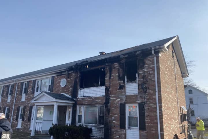 Resident Hospitalized From 3-Alarm Fire At Maynard Apartment Complex: Officials