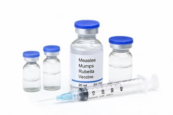 Child Contracts Measles In Fairfield County, Health Officials Say