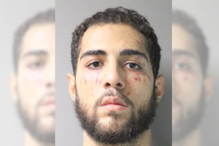 Man Kicks, Bites Woman During East Garden City Robbery: Police