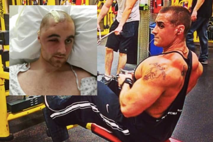 Bergen County Stroke Survivor: Steroids Ruined My Life