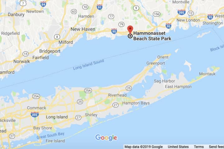 Man Has Leg Amputated After Contracting Flesh-Eating Bacteria On LI Sound