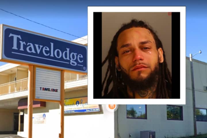 Man Punched Woman, Bit Her Nose In Lancaster Motel Argument, Authorities Say