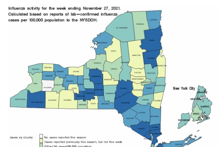 NY Sees New Increase In Flu Cases: Here Are Counties Most Affected