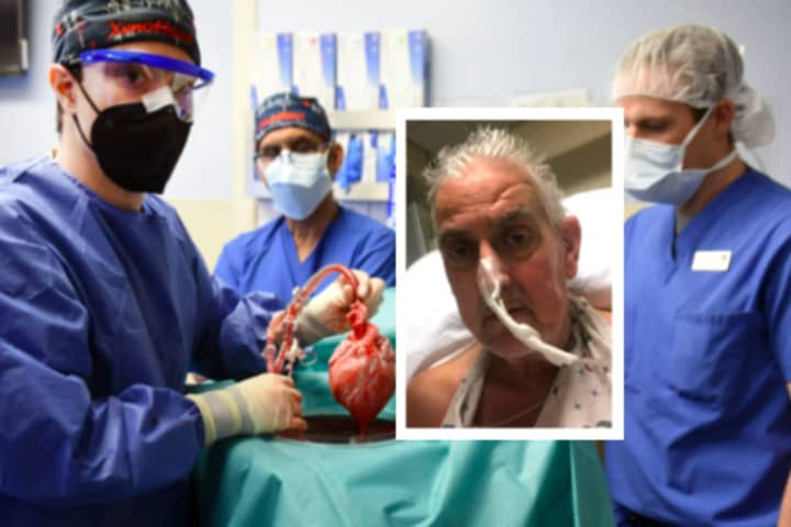 Faced With Death, Man Becomes First Human To Get Heart Transplant From Pig