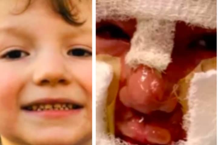 CT Family Says Video Shows 6-Year-Old Wasn’t Set On Fire By Bullies