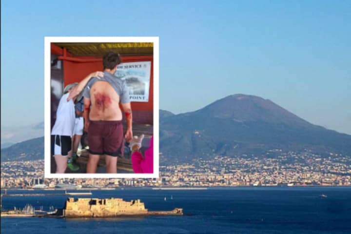 Maryland Selfie-Taker, 23, Survives Fall Into Mount Vesuvius