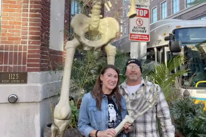 Worcester Couple Lends A Hand — And An Arm — To Cambridge Restaurant In Search Of Bones