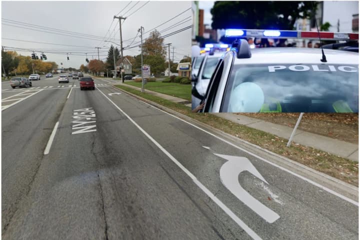 32-Year-Old Seriously Injured After Being Struck By Car On Route 25A In Mount Sinai