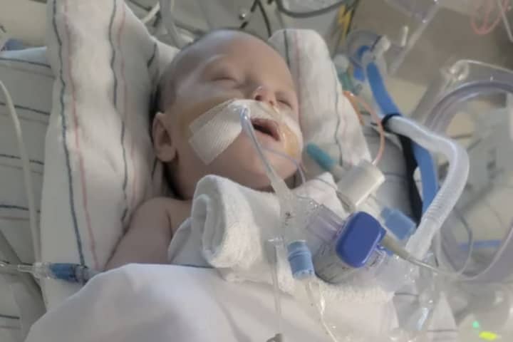 6-Week-Old Girl From Cape Cod Battling RSV At Boston's Children Hospital
