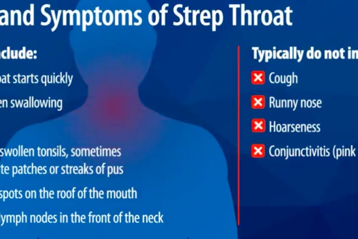 CDC Warns Of Increase In Strep Throat Infections Among Kids Amid Rise In COVID, Flu, RSV Cases