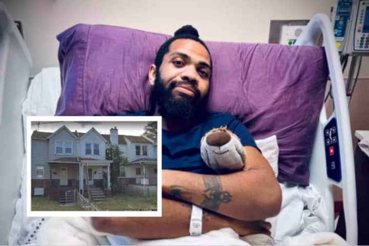 Bartender Left Paralyzed In Break-In Shooting At Upper Darby Home