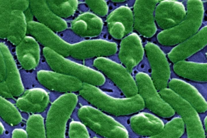 Flesh-Eating Bacteria Infections Pose Growing Threat Nationwide, CDC Warns
