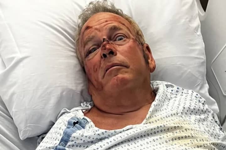 Support Pours In For Victim Run Down By ATV At Baseball Field In Hudson Valley