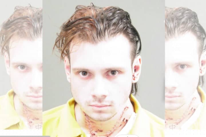 V-Shaped Gashes In Accused Killer's Neck Shown In Chilling Bucks County Mugshot