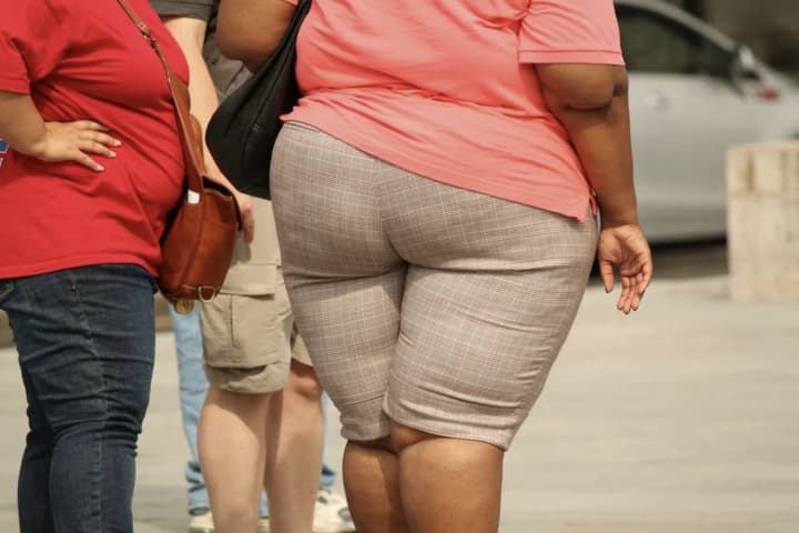 Bigger, Not Better: US Obesity Rate Expected To Skyrocket Into 2030