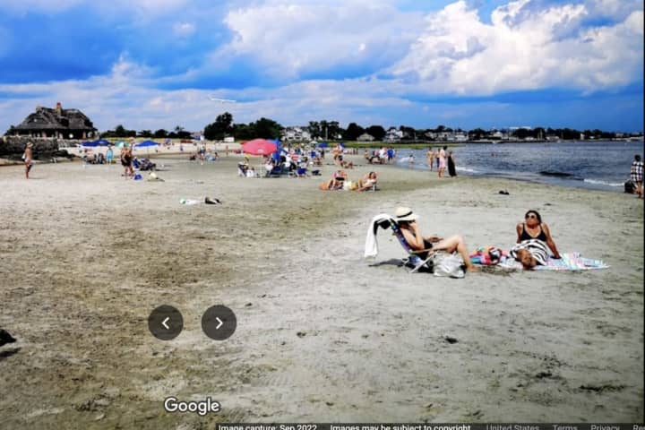 Ouch, Swimmer's Itch Reported At Beaches In CT Town