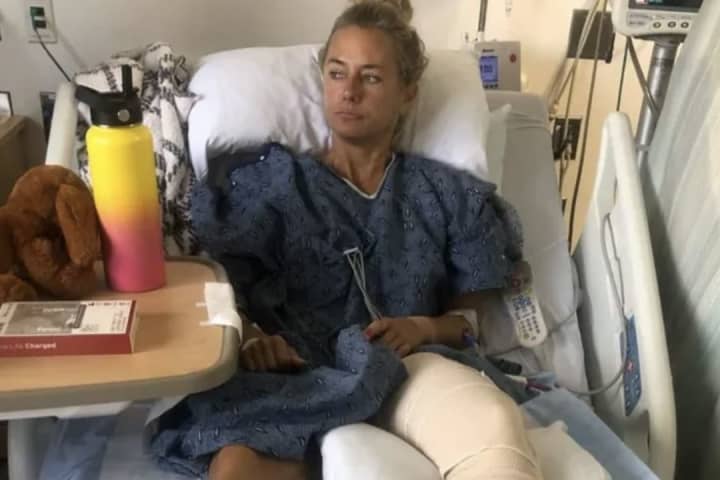 Support Pours In For Lynn Teacher Hospitalized After Stolen Car T-Boned Her: Police