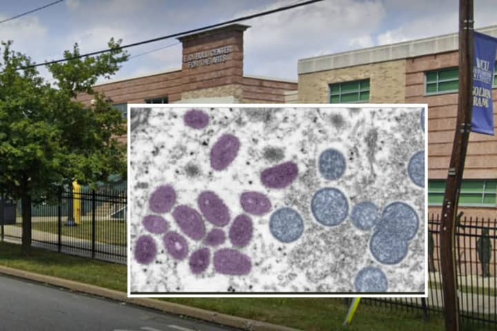 West Chester University Student Tests Positive For Monkeypox