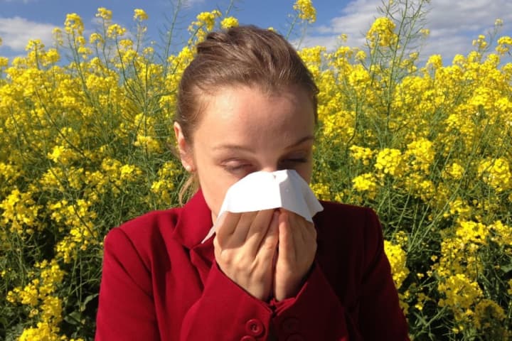 Your Allergies Are About To Get Way Worse; Holy Name Doc Has Tips