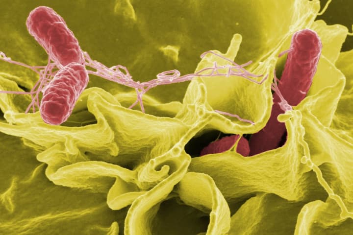 Cases Climb Of Nationwide Salmonella Outbreak From Unknown Food Source