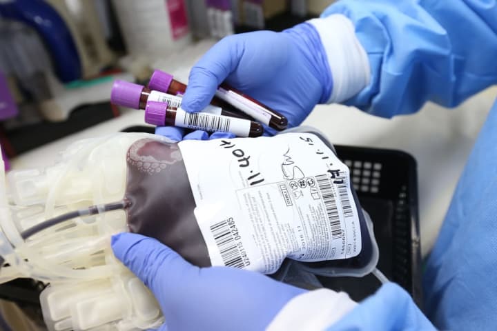 COVID-19: NY Facing Blood Emergency As Delta Variant Concerns Cause Donations To Drop