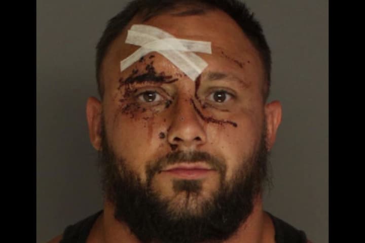 Violent Cumberland County Drunk Driver Spits Blood In Paramedic's Face, Authorities Say