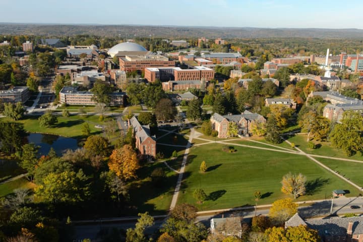 Three UConn Students Diagnosed With Mumps
