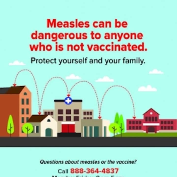 Rockland County reported Friday that there has been 157 cases of measles since the outbreak began last year.