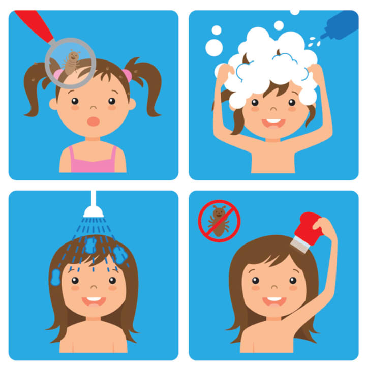 When head lice are discovered, WMC experts suggest following specific treatment steps to reduce their spread.