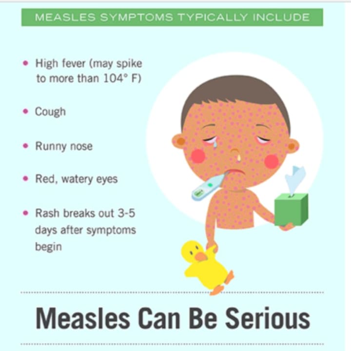 A look at measles symptoms.