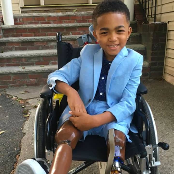 Kayden Kinckle, 6 of Englewood, is a double leg amputee and requires a bus with a wheelchair lift to take him to school. The bus company told his family that there is no bus for him this year.