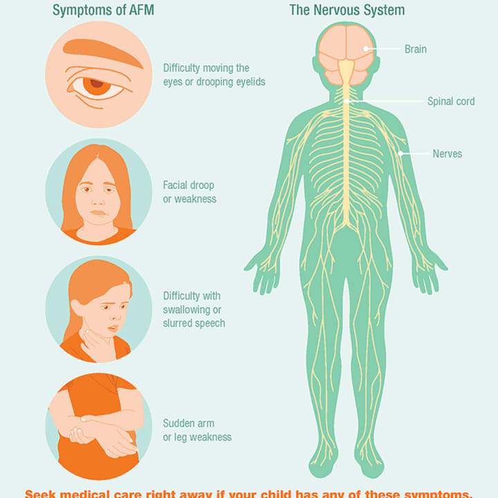 A look at symptoms of AFM.