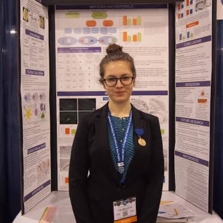 Fox Lane High School student Charlotte Herber has been involved with a groundbreaking research project into Alzheimer&#x27;s. 