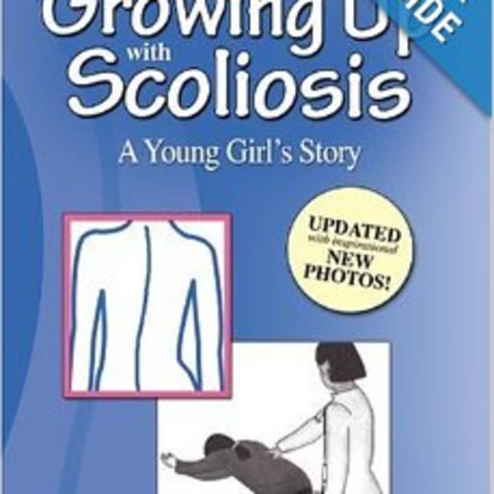 Fairfield&#x27;s Michelle Spray is turning to Kickstarter to help fund a lifelong goal of re-publishing her book &quot;Growing Up With Scoliosis.&quot; 