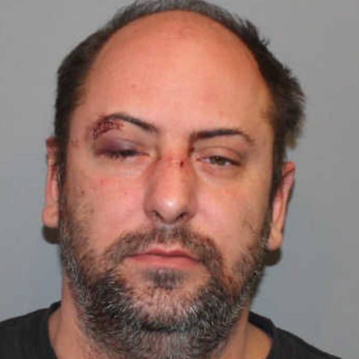 Wayne Barker, 41, of Norwalk was charged with assault on a medical professional and other charges Sunday. 