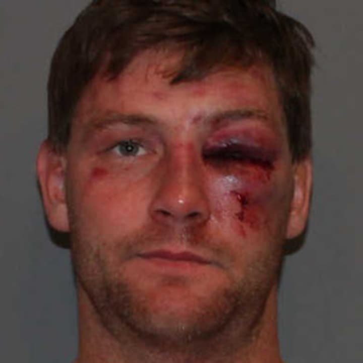 Christian Garnett, 32, was charged with assault on a police officer and driving under the influence Oct. 31 by Norwalk Police.