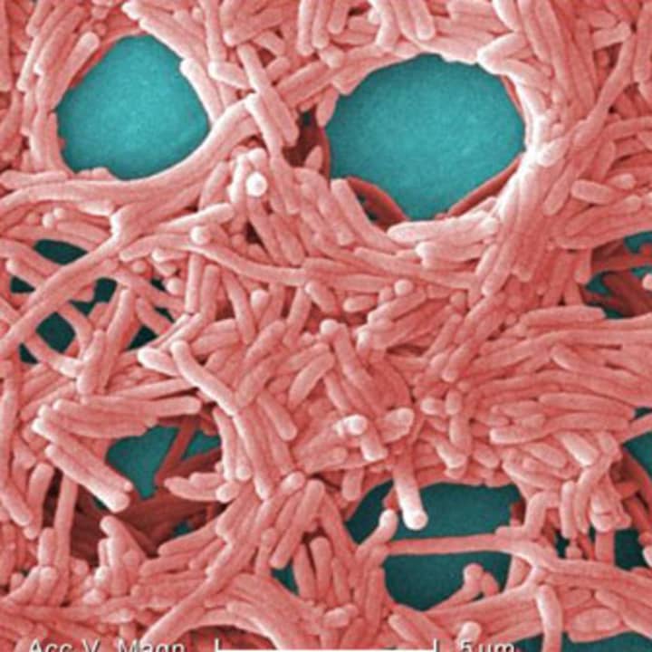 The Legionella bacterium causes the deadly pneumonia-like Legionnaires&#x27; disease.