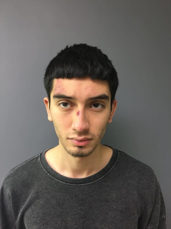 DA: 20-Year-Old South Jersey Man Points Stolen Gun At PA Officer's Head, Pulls Trigger