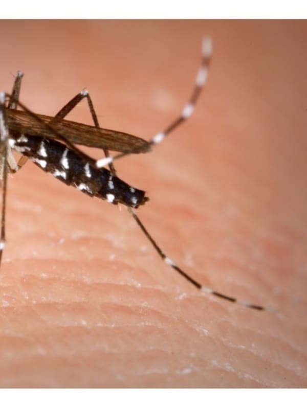 First Case Of Zika Virus Detected In Rockland