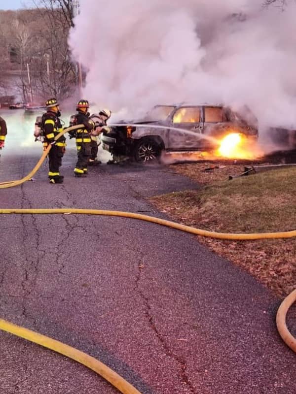 Driver Severely Burned In Vehicle Fire In Northern Westchester