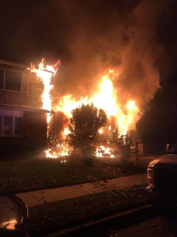 Photos: Three Injured, Two Dogs Killed After Fire Breaks Out At Adjacent Long Island Homes