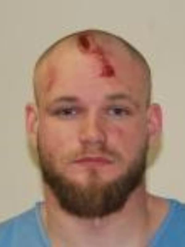 Wappinger Man Stabs Landlord With Kitchen Knife, Police Say